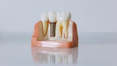 dental care in hungary