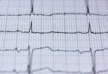 apex pulse 932207912 stellar node